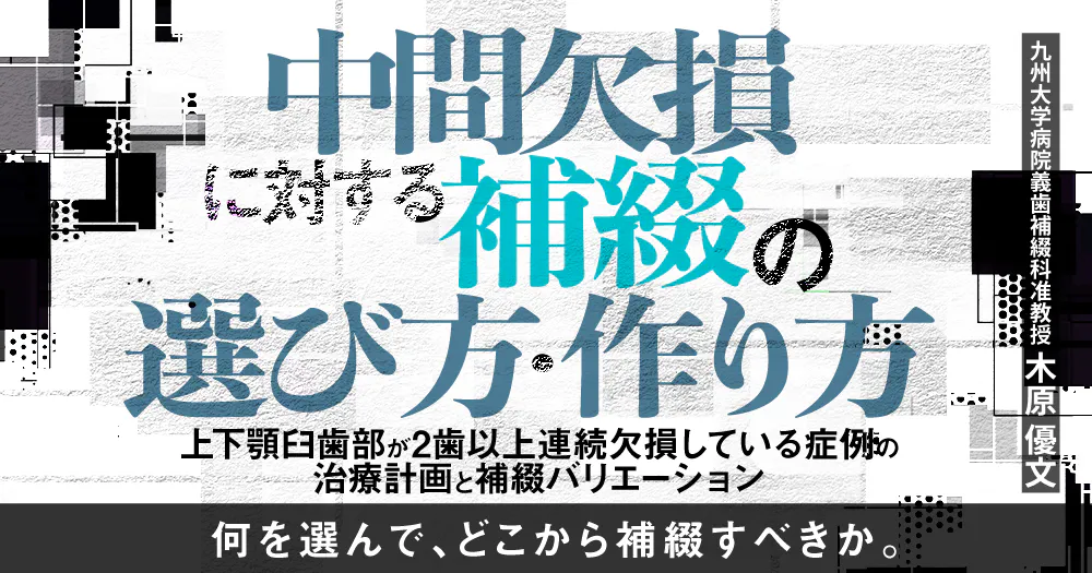 中間欠損に対する補綴の選び方・作り方｜歯科オンラインセミナー・録画