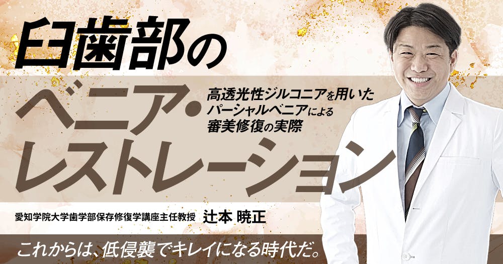 歯に優しいけどムズかしい、接着ブリッジの臨床論。デザイン・形成の