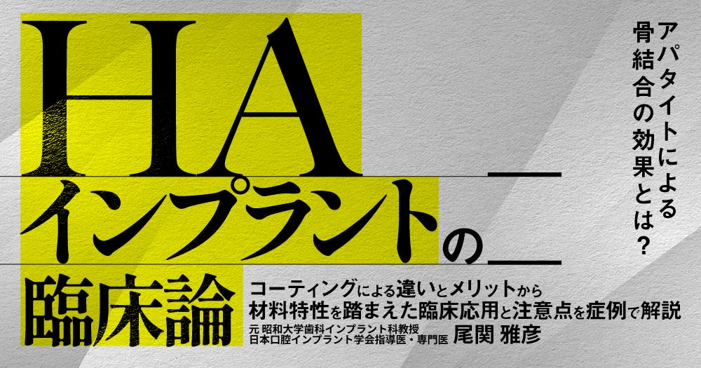 イチから学ぶ「即時荷重インプラント」｜歯科オンラインセミナー・録画