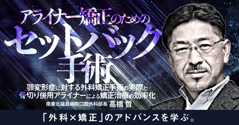 裁断済み アライナー矯正治療 診断/治療計画/矯正治療/顎位整復治療 Amazon.co.jp: アライナー矯正治療 診断/治療計画/矯正治療/顎位