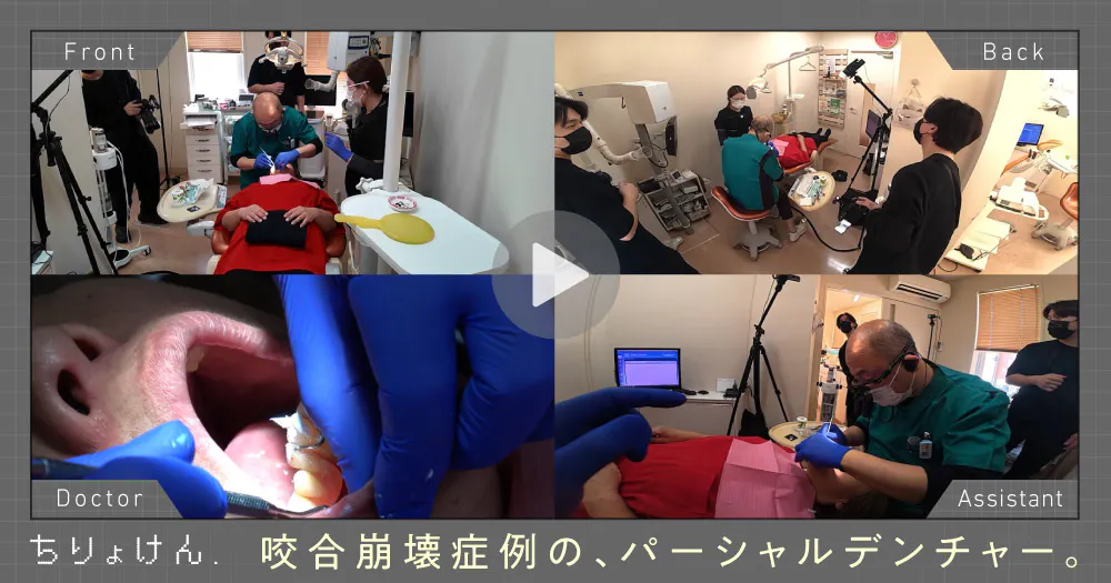 保険高速審美修復｜歯科オンラインセミナー・録画配信は1D（ワンディー）