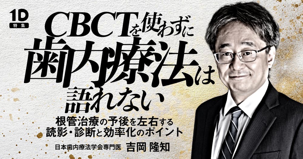 根管洗浄がもっと良くなるツールたち｜歯科オンラインセミナー・録画