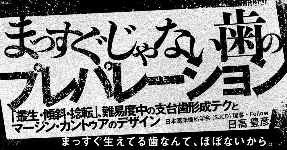 まっすぐじゃない歯のプレパレーション｜歯科オンラインセミナー・録画