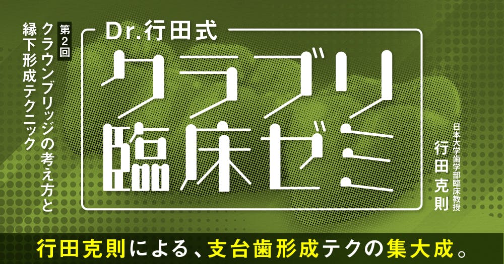接着ブリッジ講座 Amazon.co.jp: これから始める歯科医師のための接着ブリッジ講座