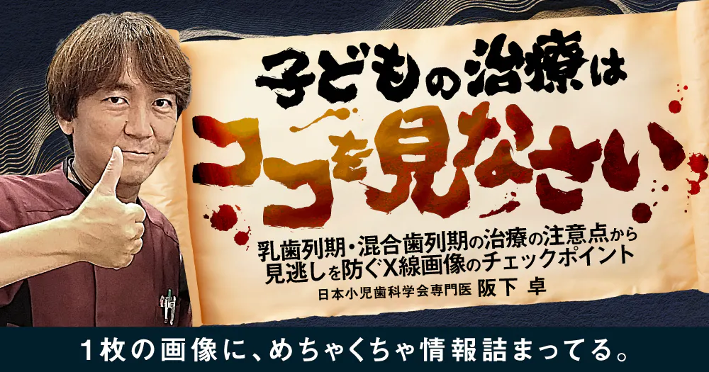 小児の接着、なんかムズい。う蝕処置における防湿とGICの応用、チェア