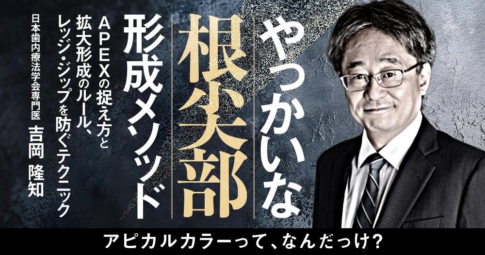 全5回】歯内療法マスタークラス第3回。よくあるエンドの悩みを、理論的