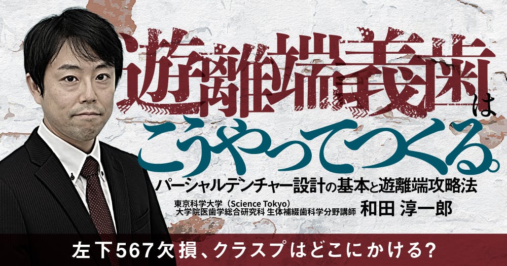 パーシャルデンチャーを得意になろう! 設計原則からトラブル対応までの臨床ガイド 設計原則からトラブル対応までの臨床ガイド パーシャル