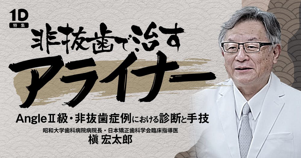 非抜歯で治すアライナー｜歯科オンラインセミナー・録画配信は1D