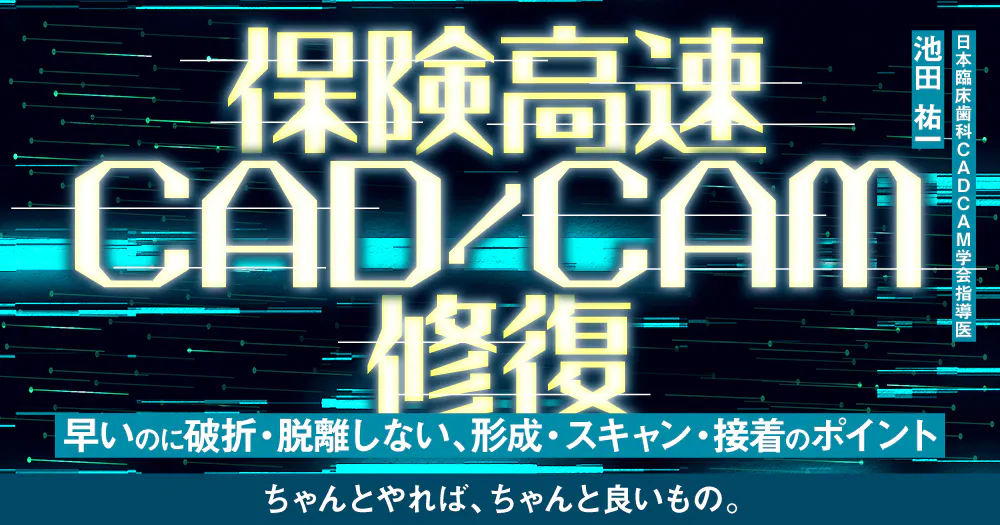 保険高速CAD/CAM修復｜歯科オンラインセミナー・録画配信は1D