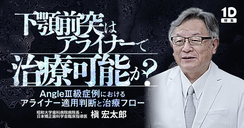 下顎前突はアライナーで治療可能か？｜歯科オンラインセミナー・録画