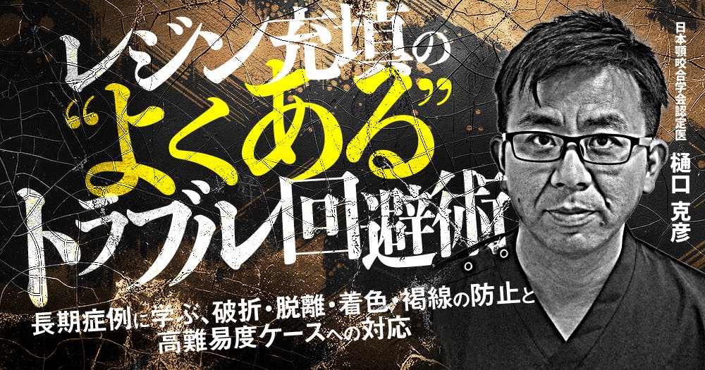 保険高速審美修復｜歯科オンラインセミナー・録画配信は1D