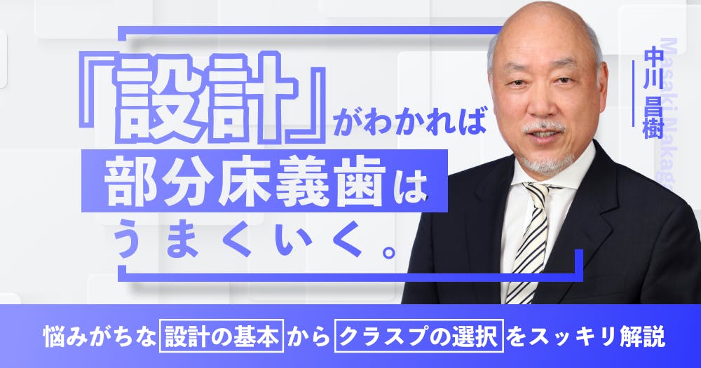 設計」がわかれば部分床義歯はうまくいく｜歯科オンライン