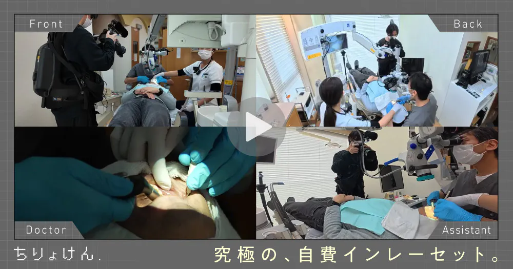治療見学】セラミックインレーセット（上顎左側第一大臼歯）｜歯科