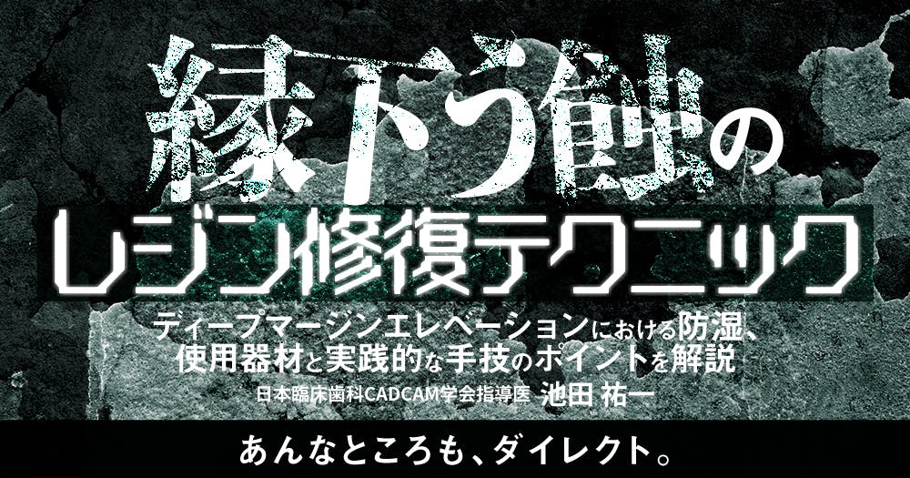 インプラント「撤去」の診断とテクニック｜歯科オンラインセミナー