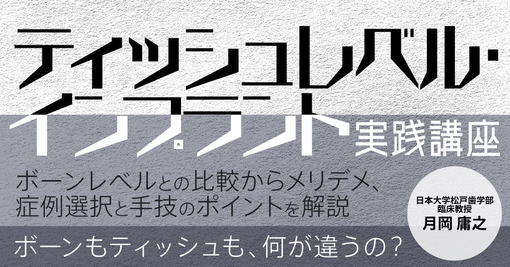 ティッシュレベル・インプラント実践講座。ボーンレベルとの違い