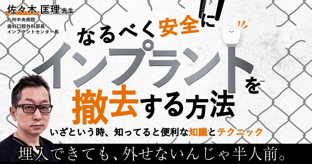 インプラントの撤去　～リスク診断から再埋入まで～ インプラントの撤去リスク診断から再埋入まで