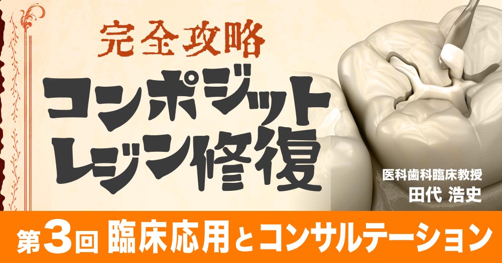 完全攻略】コンポジットレジン修復｜歯科オンラインセミナー