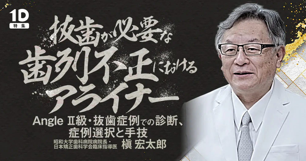 抜歯が必要な歯列不正におけるアライナー｜歯科オンラインセミナー