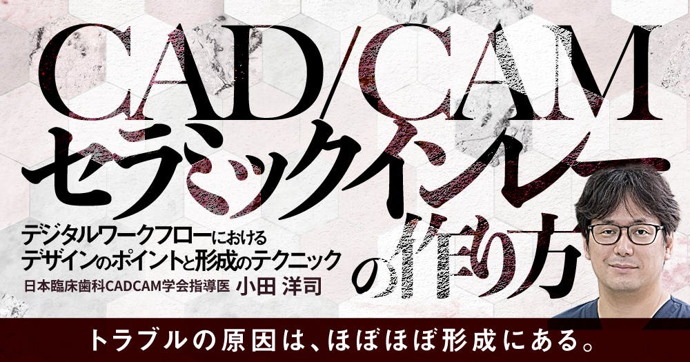 CAD/CAMセラミックインレーの作り方｜歯科オンラインセミナー・録画