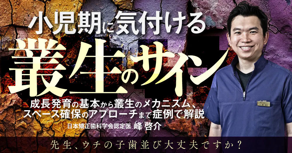 小児期に気付ける叢生のサイン｜歯科オンラインセミナー・録画配信は1D