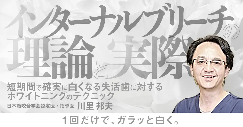 田上順次先生の「ザ・ホワイトニング」。導入のすすめとメインテナンス