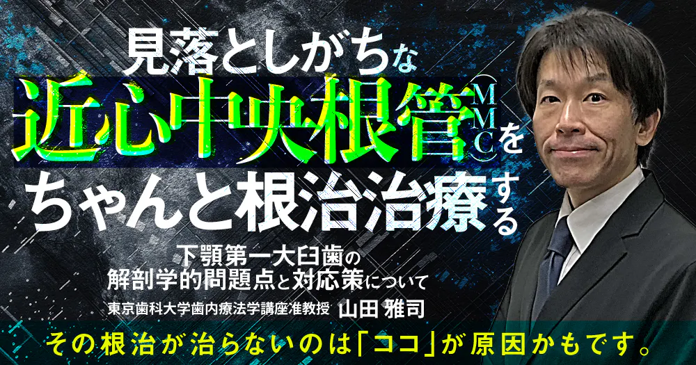 対談】上顎第一大臼歯の根管形態を探る#2｜歯科オンラインセミナー
