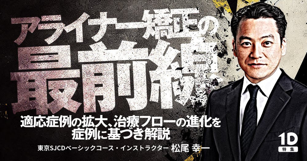 アライナー矯正の最前線｜歯科オンラインセミナー・録画配信は1D