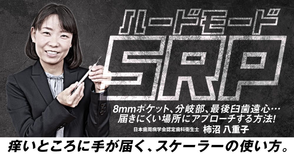 ⚠裁断済　歯周治療失敗回避のためのポイント33 : なぜ歯周炎が進行するのか、… ⚠裁断済 歯周治療失敗回避のためのポイント33 : なぜ歯周