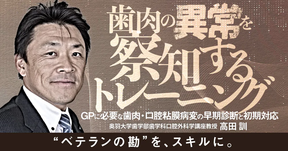 GPのための「永久歯の外傷」｜歯科オンラインセミナー・録画配信は1D