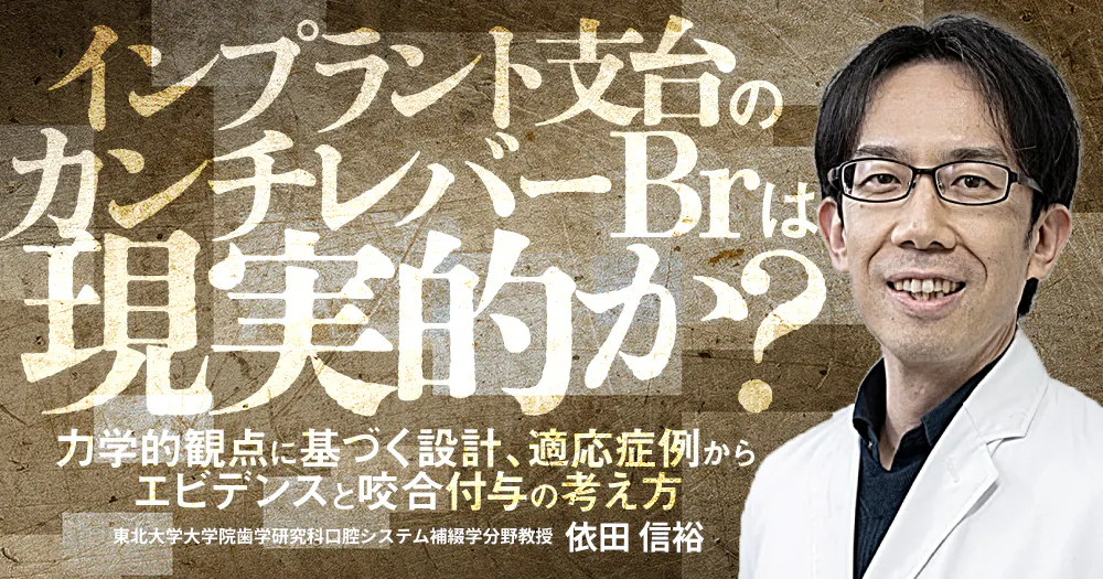 明日から使える「欠損補綴」の保険請求｜歯科オンラインセミナー・録画