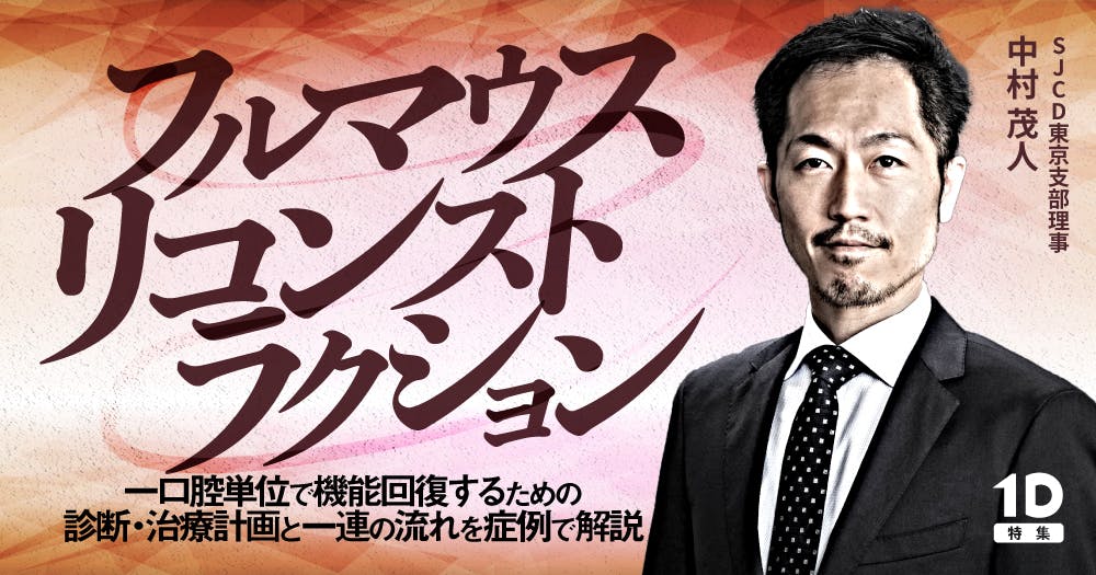 科学的に解明する「下顎位の迷信」全顎治療のための顎位の知識と中心位