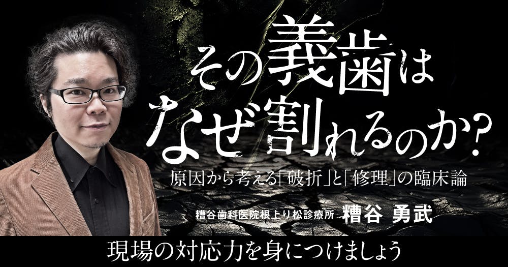 知って得する「ティーコン」活用術。ティッシュコンディショナー