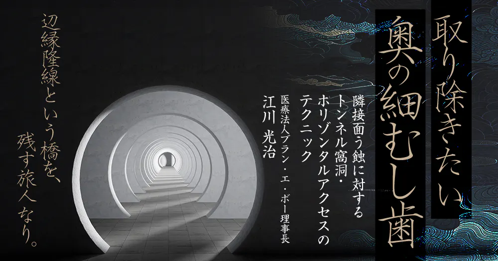 義歯の「咬合調整」大攻略｜歯科オンラインセミナー・録画配信は1D