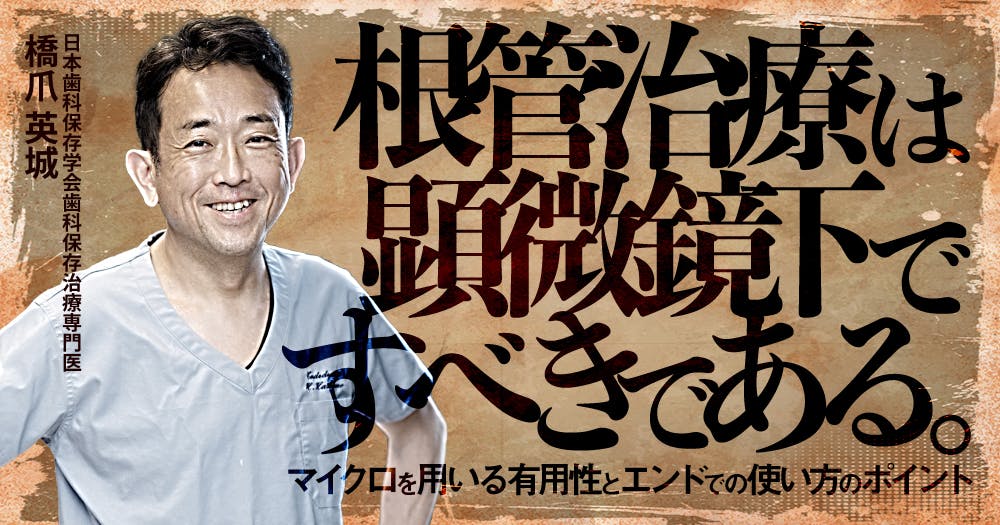 保存修復学 エンドドンティクス 保存修復学 エンドドンティクス