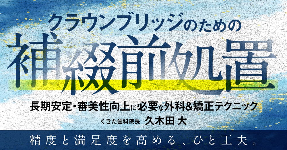 クラウンブリッジのための「補綴前処置」。長期安定・審美性向上に必要