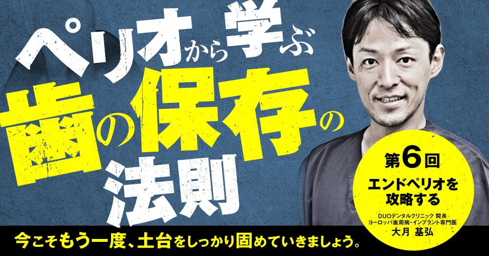 ペリオから学ぶ歯の保存の法則【第四回】歯周病の基礎知識。｜歯科