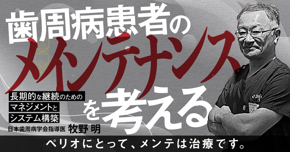 ⚠裁断済　歯周治療失敗回避のためのポイント33 : なぜ歯周炎が進行するのか、… 歯周治療 失敗回避のためのポイント33 - クインテッセンス出版