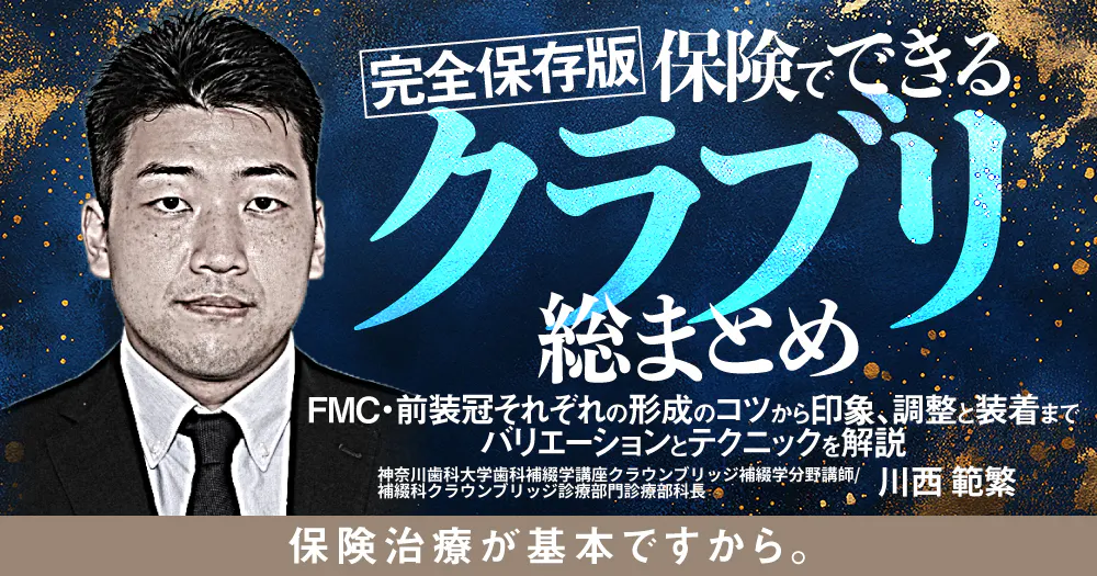 完全保存版】保険でできるクラブリ総まとめ｜歯科オンラインセミナー