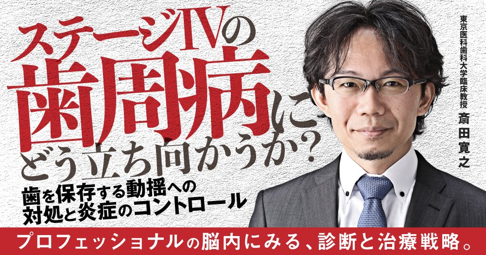 ⚠裁断済　歯周治療失敗回避のためのポイント33 : なぜ歯周炎が進行するのか、… なぜ、あなたの歯周治療は失敗するのか？｜歯科オンライン