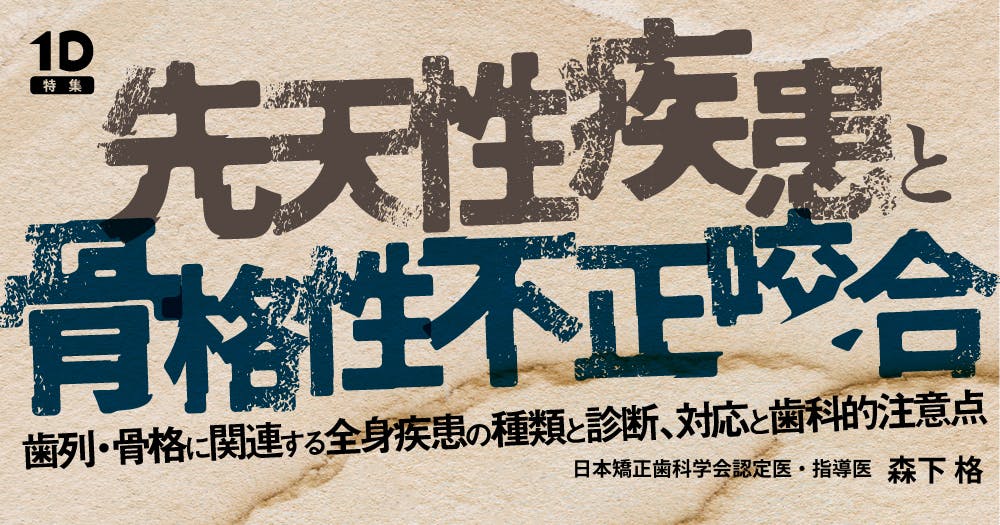 先天性疾患と骨格性不正咬合｜歯科オンラインセミナー・録画配信は1D