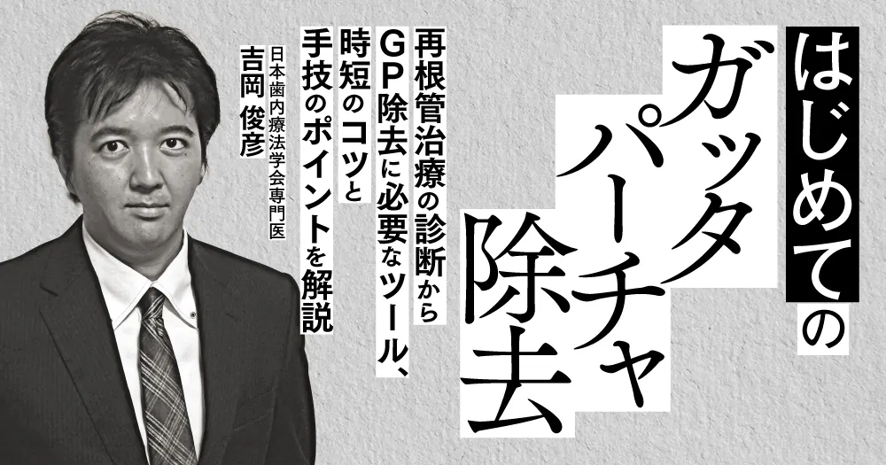 クラウン・ポストなど、なかなか外れない補綴物を効率的に撤去する方法