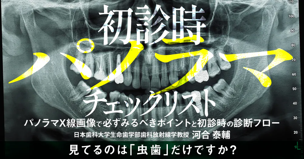 初診時「パノラマ」チェックリスト｜歯科オンラインセミナー・録画配信