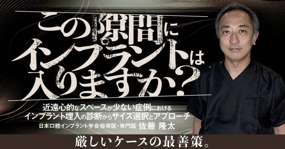 この隙間にインプラントは入りますか？｜歯科オンラインセミナー・録画