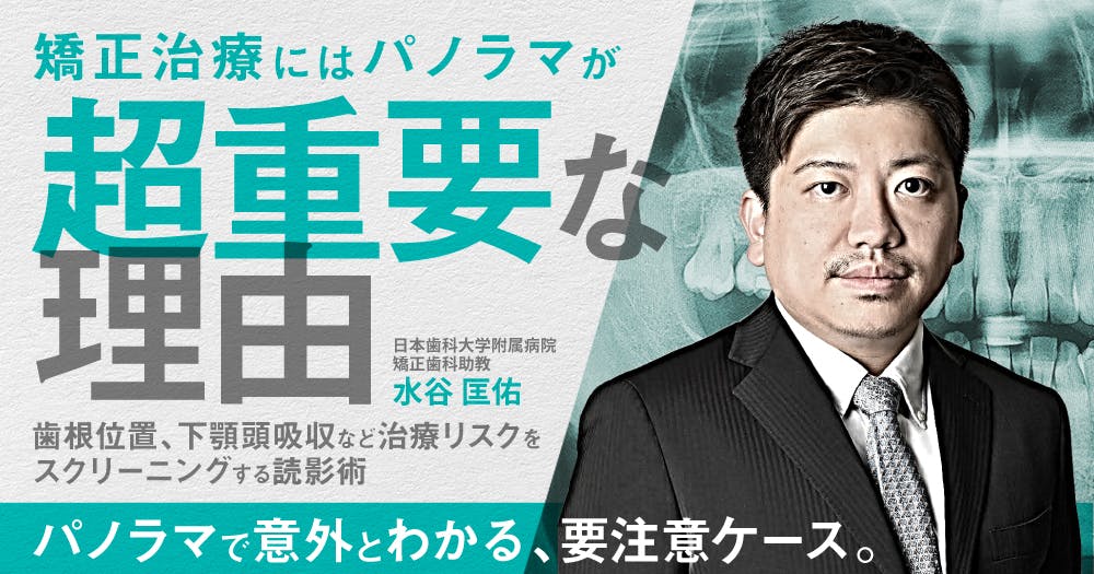 フルパッシブ矯正」とはなんぞや｜歯科オンラインセミナー・録画