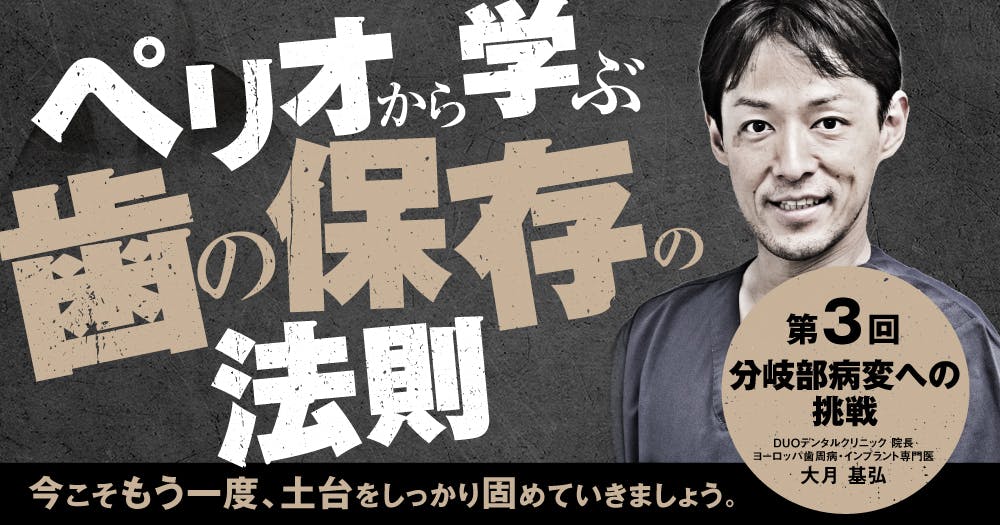 ペリオから学ぶ歯の保存の法則【第3回】歯周病の基礎知識を解説｜歯科
