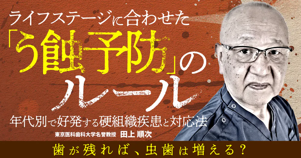 田上順次先生の「ザ・ホワイトニング」。導入のすすめとメインテナンス