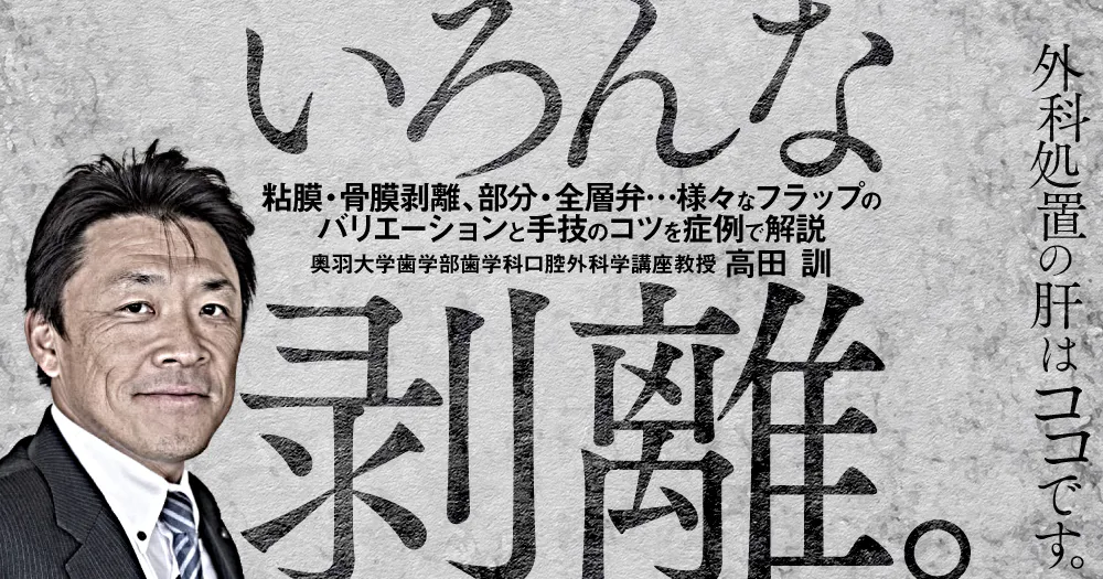 いろんな剥離。｜歯科オンラインセミナー・録画配信は1D（ワンディー）