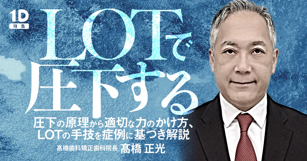 矯正臨床: 一般歯科医のための理論と実務 高橋 正光 矯正臨床: 一般歯科医のための理論と実務 | 高橋 正光 |本 | 通販 | Amazon