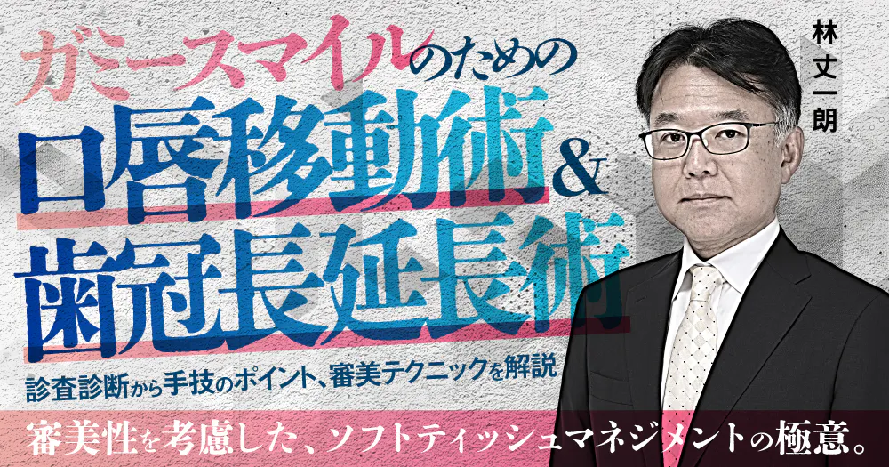 通販売 インプラント・歯周再建治療のティッシュマネージメント 【公式