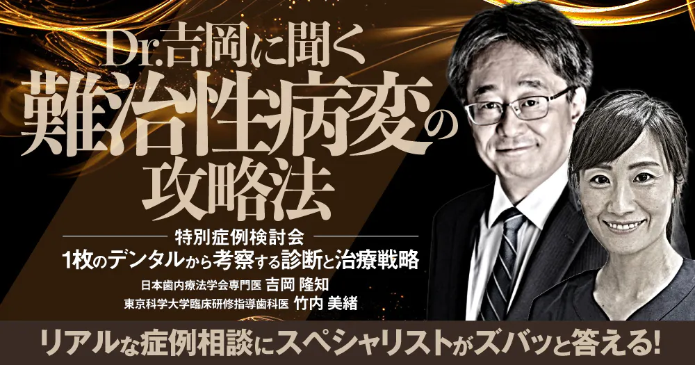 成功率の低い根治」vs「抜歯してインプラント」。保存治療の分岐点、何